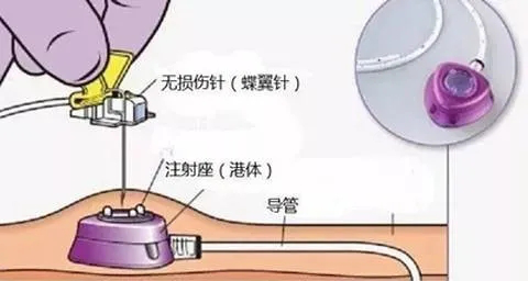 5月13日乳腺癌患者化疗期间注意事项3.png