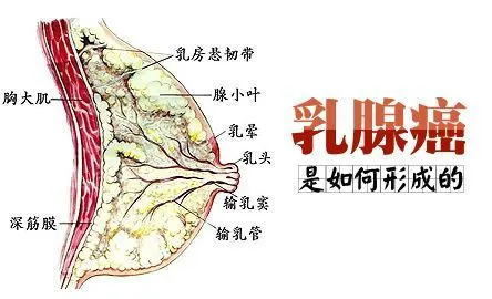 5月19日甲状腺癌与乳腺癌的关系！1.png