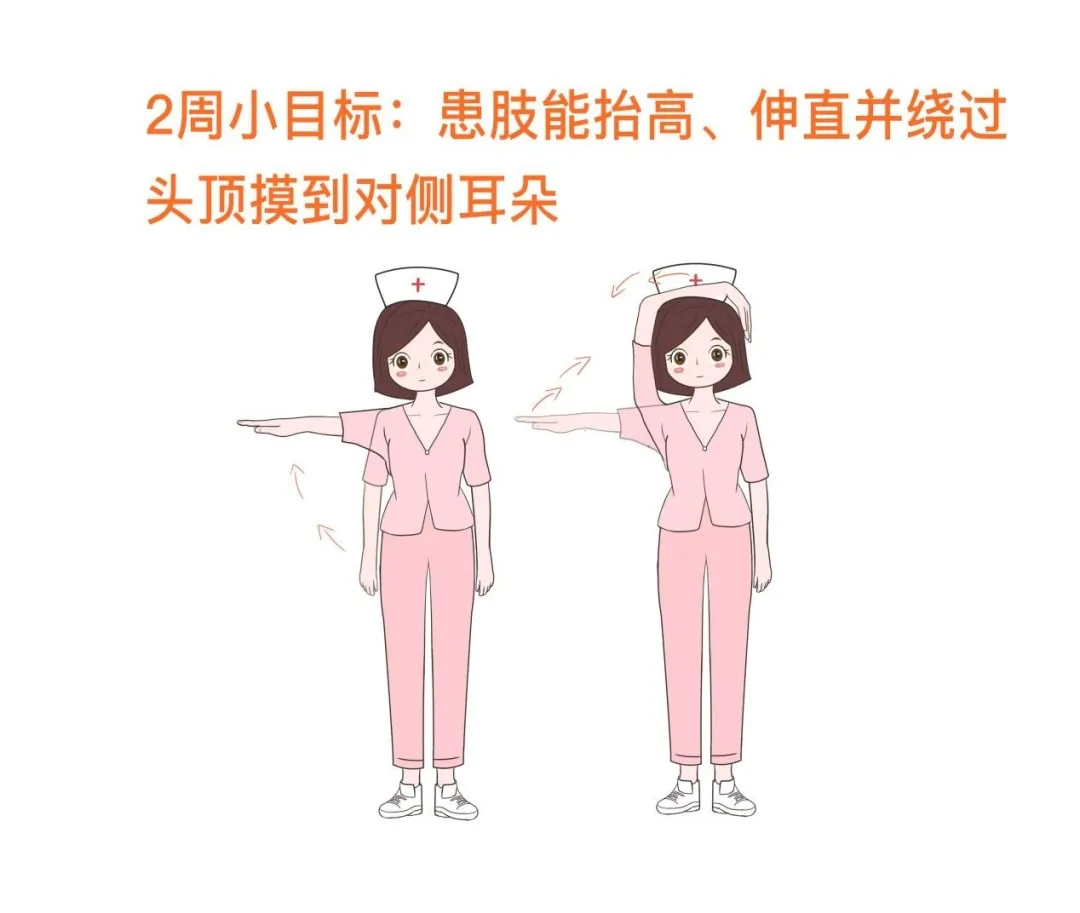 5月25日乳腺癌术后的康复锻炼6.png