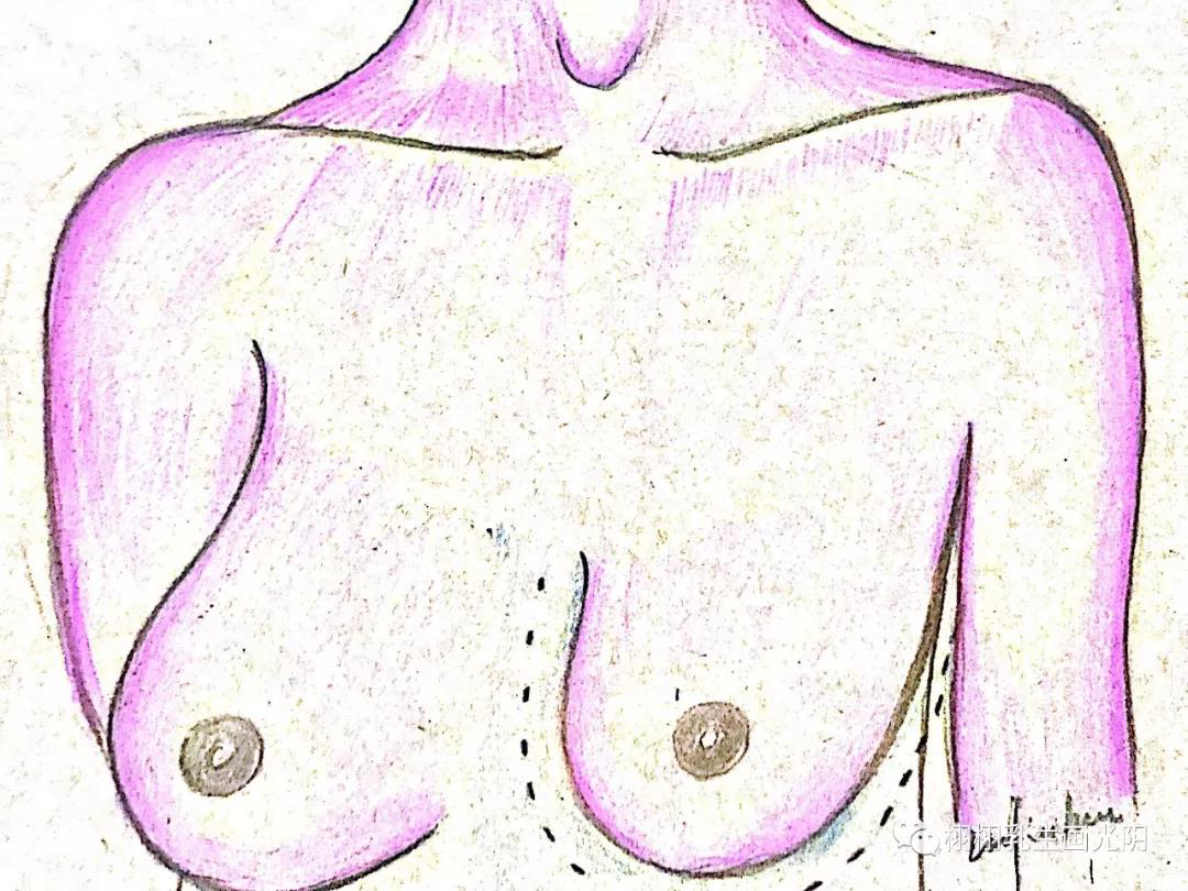 6月17日图解女人裸露的灵魂-乳房常识11.png
