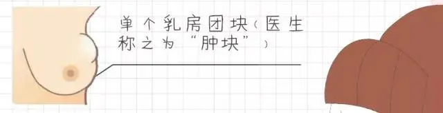 9月2日（周三）次条：10种乳房变化，出现任意一种都要注意！4.png