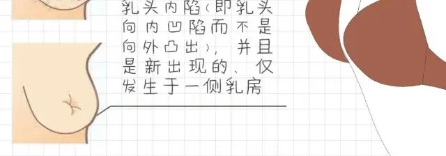 9月2日（周三）次条：10种乳房变化，出现任意一种都要注意！6.png