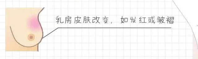 9月2日（周三）次条：10种乳房变化，出现任意一种都要注意！8.png