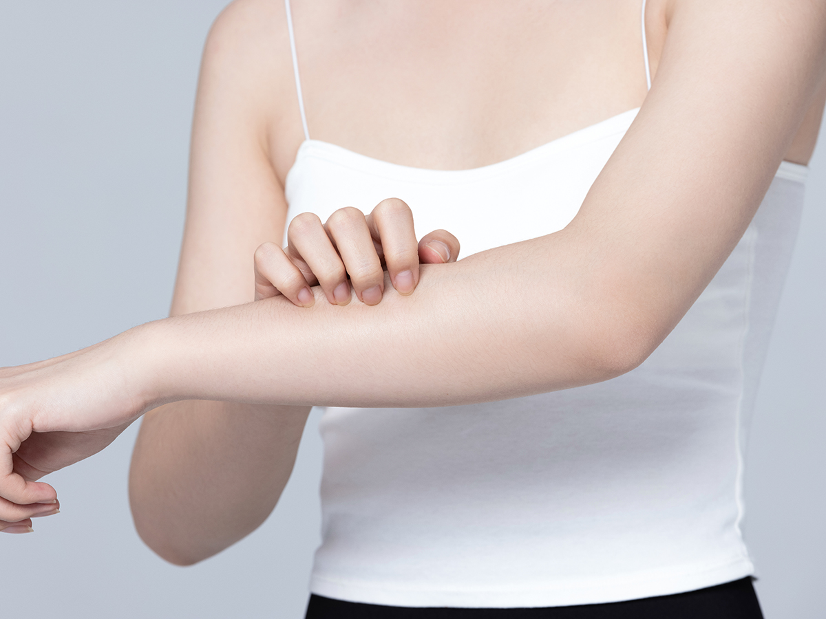 摄图网_501700721_皮肤过敏抓挠手臂的女性（企业商用）.jpg